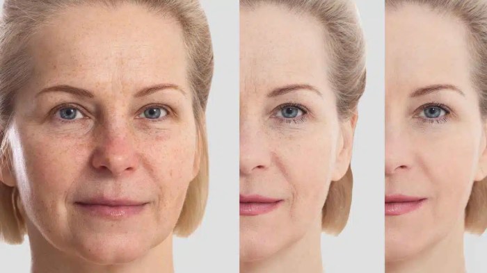 How soon after microneedling can i wear makeup